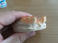 Medische toepassingen 3D-printen