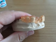 Prototype boormal voor de tandartspraktijk, geprint met de Atum 3D T-Rex 3D printer.